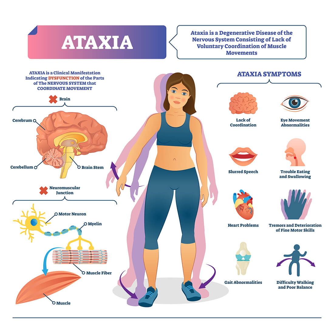 Ataxie Dystaxia Wat Is Dit Oorzaken Symptomen Diagnostiek | My XXX Hot Girl